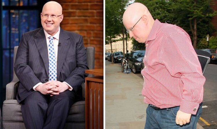 Matt Lucas health: Bake Off host on his alopecia - 'I found several hairs on my pillow'