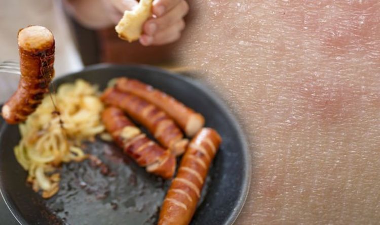 High cholesterol: 11 body parts affected by eruptive xanthomatosis warning of high levels