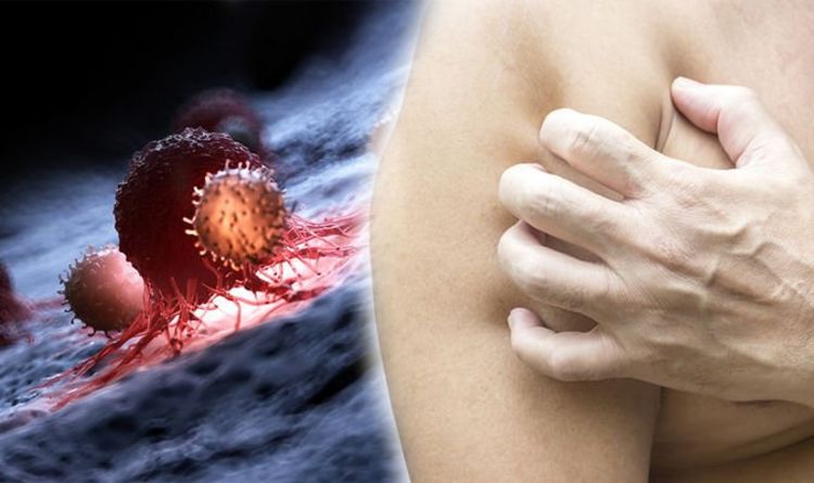 Blood cancer: Does your skin feel a certain way? Unusual warning sign in this sensation