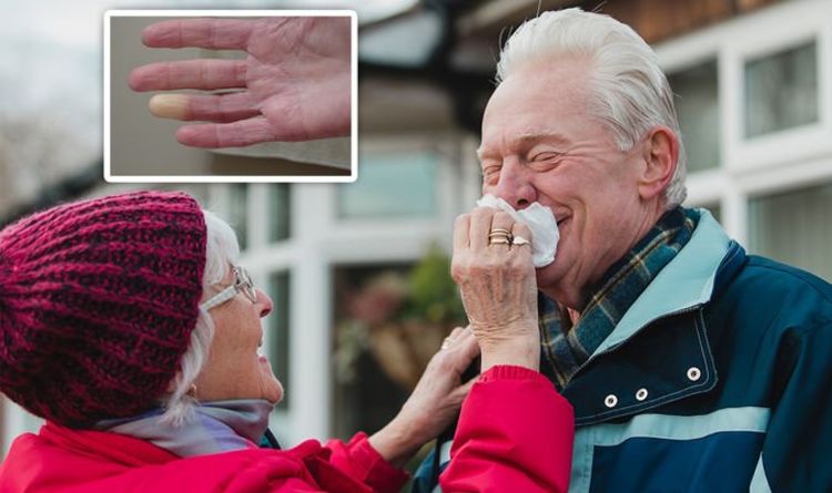Raynaud's disease: How to stop throbbing fingertips when coming in from the cold