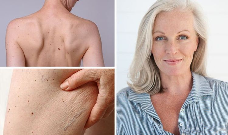 Skin cancer symptoms: The difference between normal and cancerous moles on your body