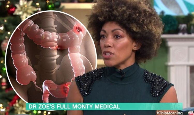 Dr Zoe health latest: Full Monty On Ice Star provides bowel cancer update