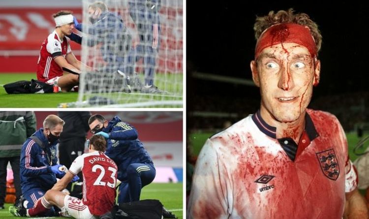 Terry Butcher warns David Luiz and modern stars over concussions - 'Don't be like me!'