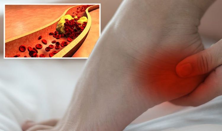 High cholesterol symptoms: The hidden sign on your ankle of high cholesterol levels