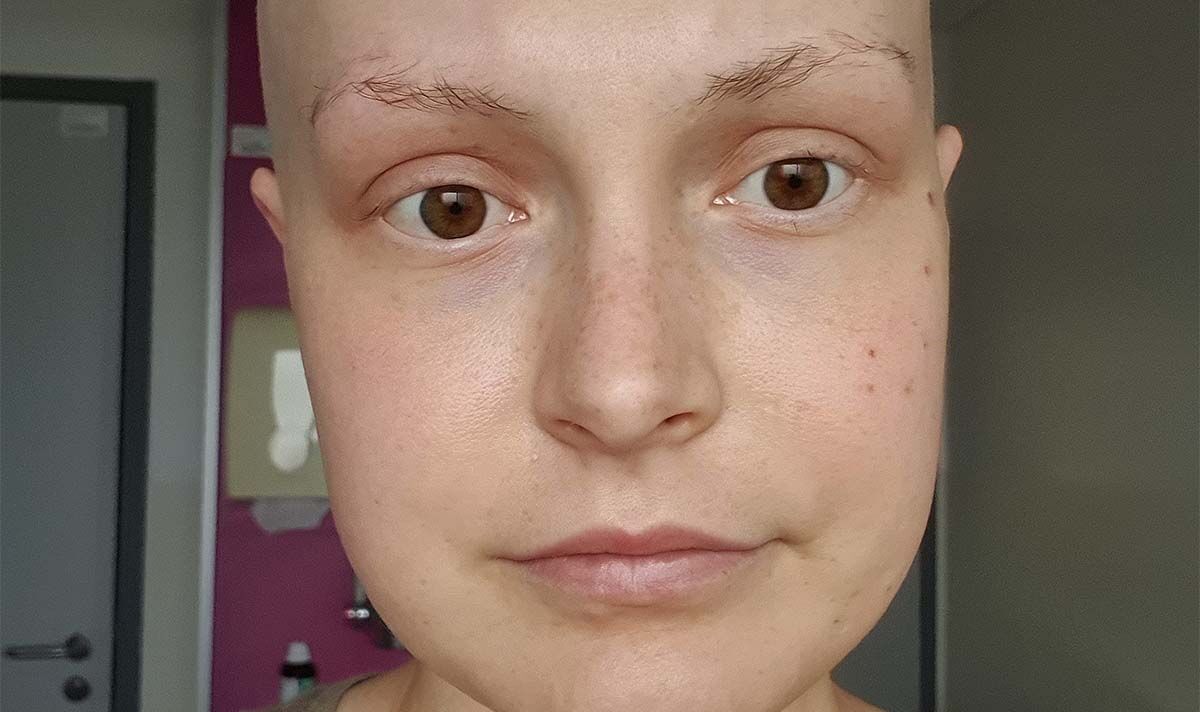 Graduate, 24, 'ignored' cancer symptoms for 'months’ - signs to spot