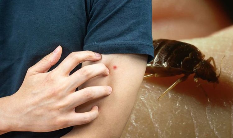 Bed bug bites: Signs usually show up ‘close to blood vessels’ - where to look