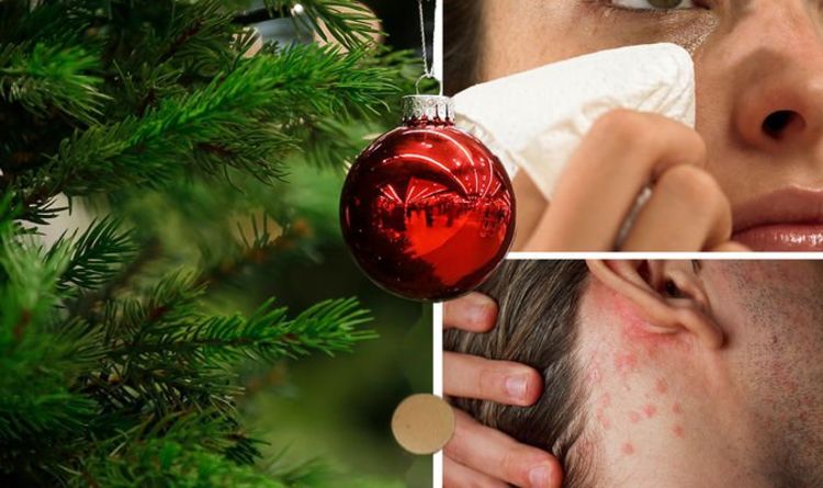 Christmas tree syndrome - do you have it? Six symptoms to watch out for