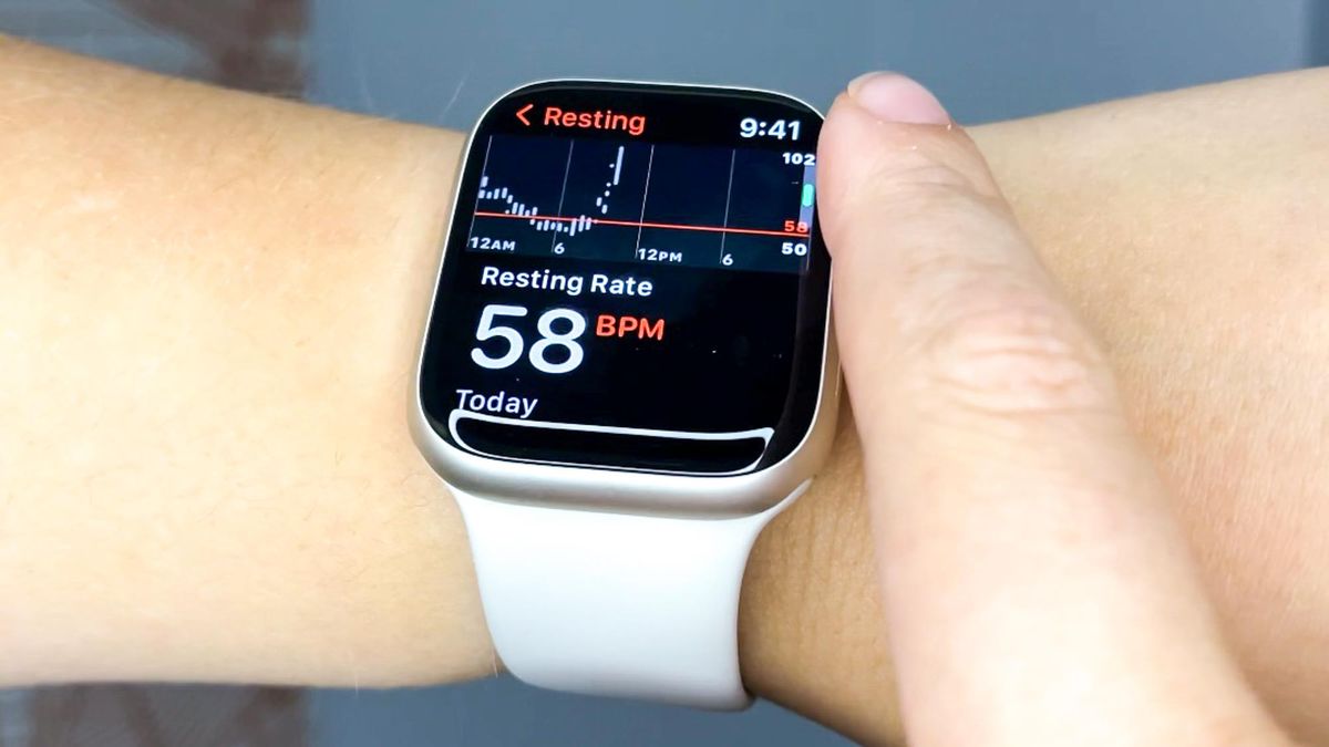 Apple Watch helps woman discover heart tumor — doctors call it a 'silent time bomb'