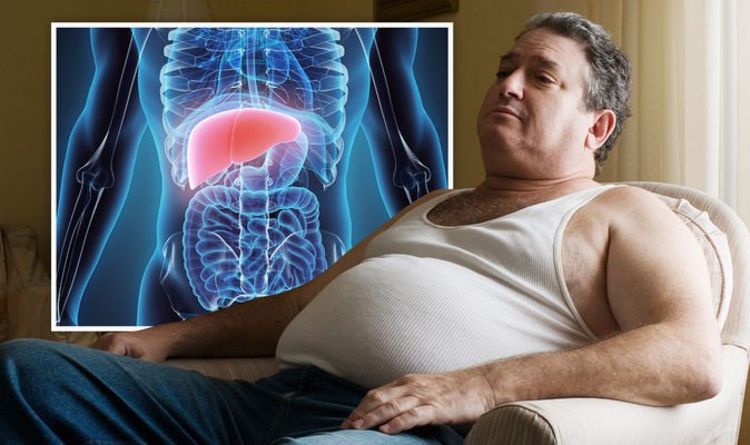 Fatty liver disease symptoms: The colour of your eyes could indicate you have the disease
