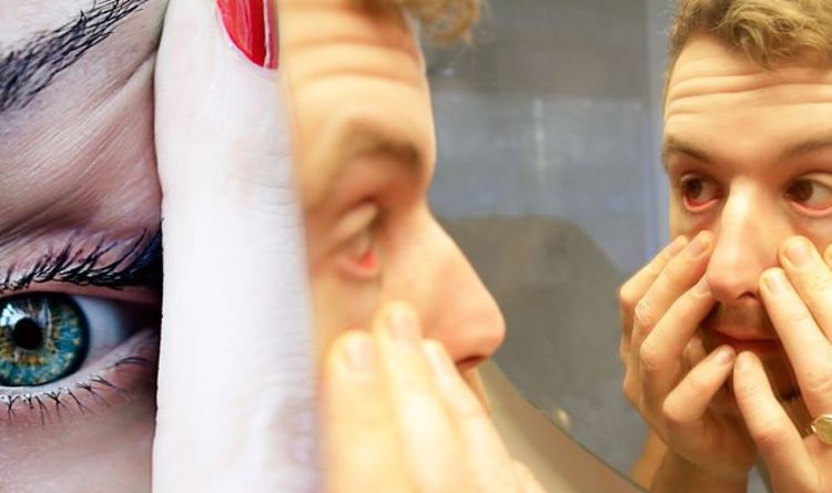 Coronavirus UK update: Burning, gritty, itchy and watery eyes could be symptoms to spot