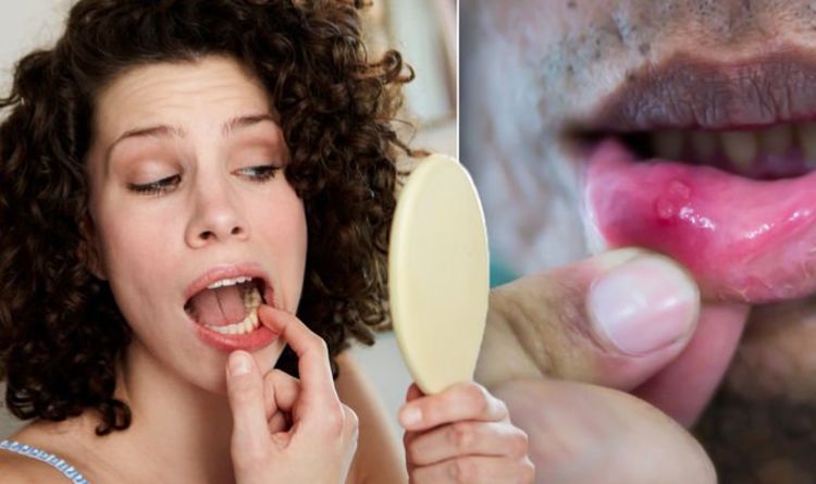 Cancer warning: Seven symptoms of a deadly tumour in your mouth that you may be missing