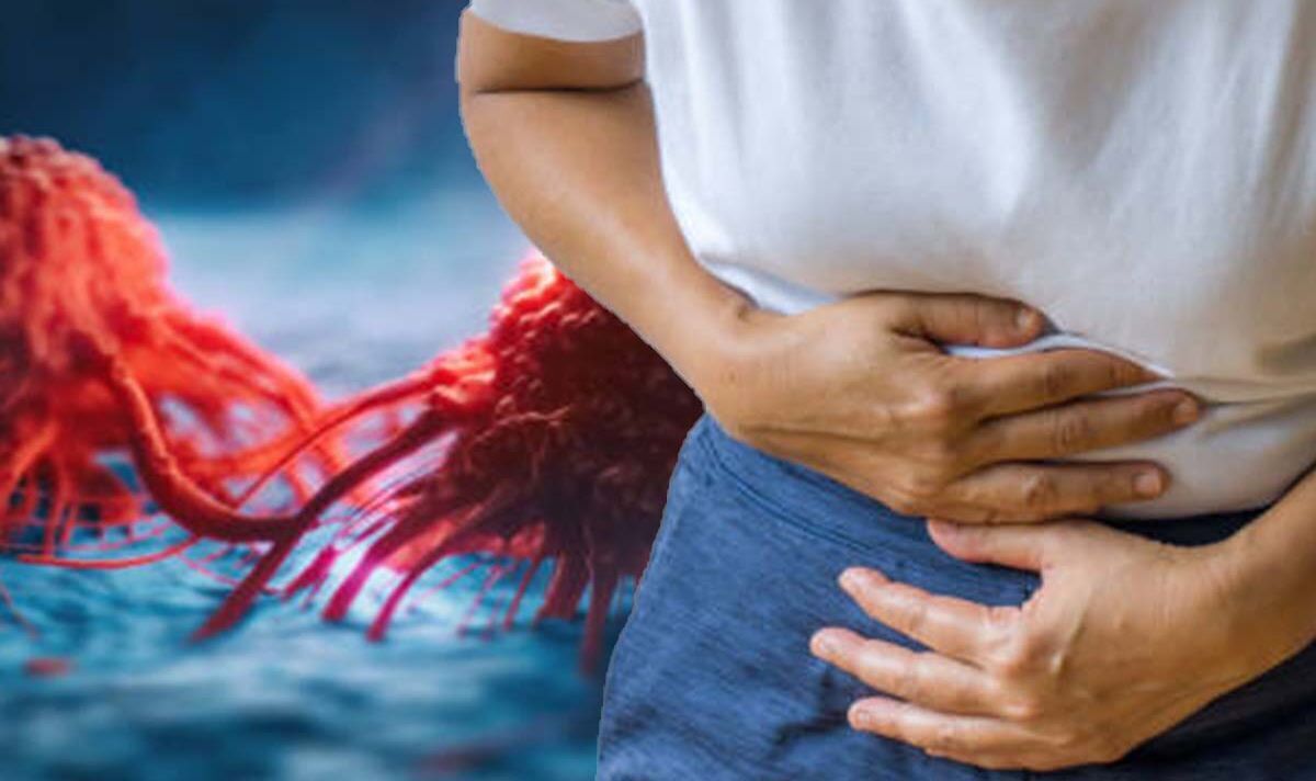 Ovarian cancer symptoms: The 'very vague' signs which can indicate 'early stages'