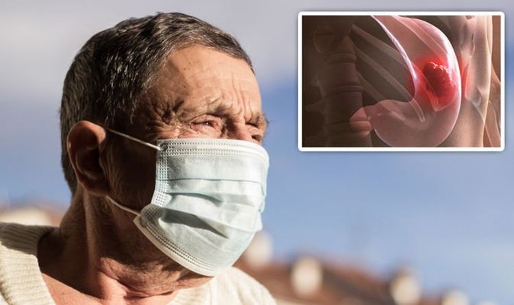 Stomach cancer symptoms: Ongoing dyspepsia could be a warning sign of the disease