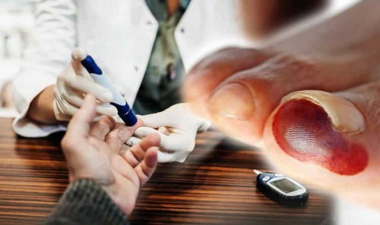 Type 2 diabetes: Gangrene & high blood sugar – what is the link? How to know your risk