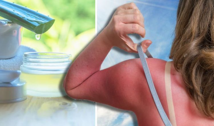 How to soothe sunburn - 5 tips for cooling burnt skin