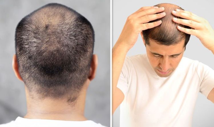 Hair loss treatment: A four-minute scalp massage daily could promote hair growth
