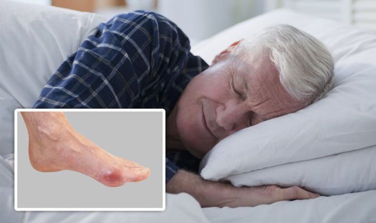 Gout treatment: A ‘bed cage’ could ease any joint discomfort