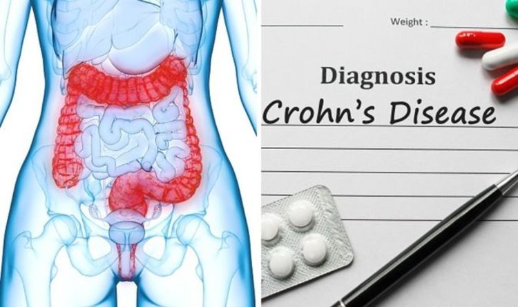 Crohn’s symptoms: What is Crohn's disease, and what causes it?