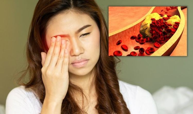 High cholesterol symptoms: 'Potentially blinding' sign of high cholesterol in your eyes
