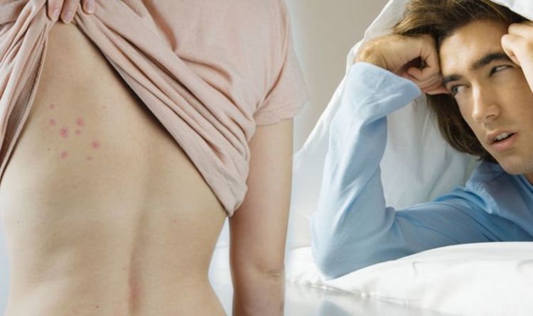 Bedbugs: New strange odour, exoskeleton and spots on mattress are signs to look out for