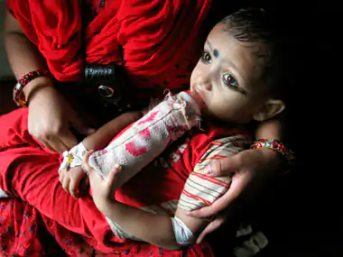 New Thalassemia treatment techniques both encouraging and deterring: Here's why