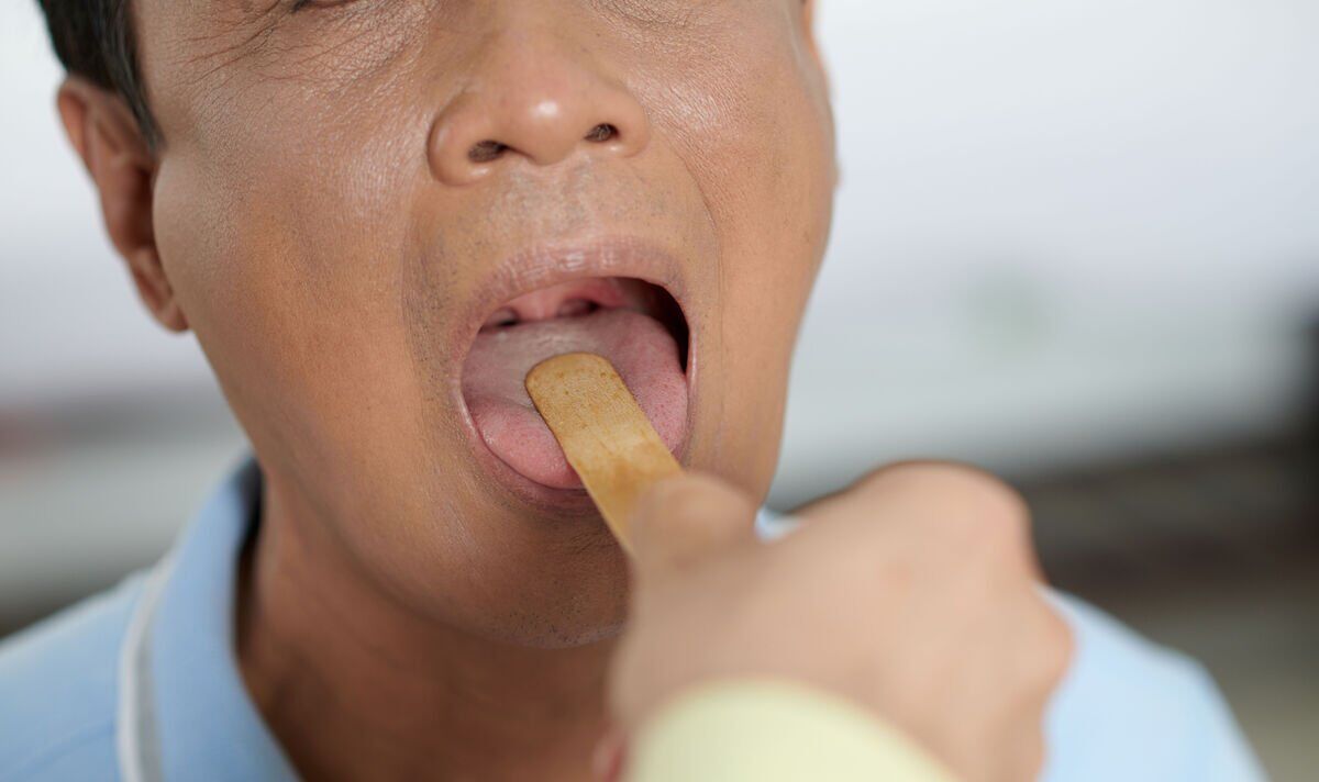 Early stroke warning signs may include ‘tongue deviation’