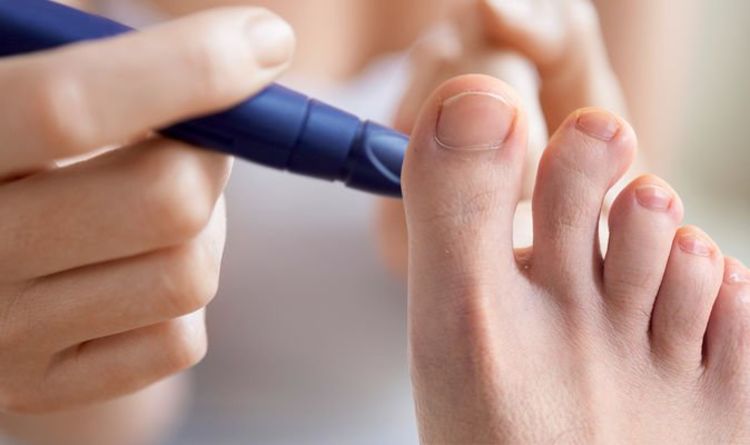 Diabetes type 2 symptoms: ‘Hammer toes' are a warning sign of blood sugar damage