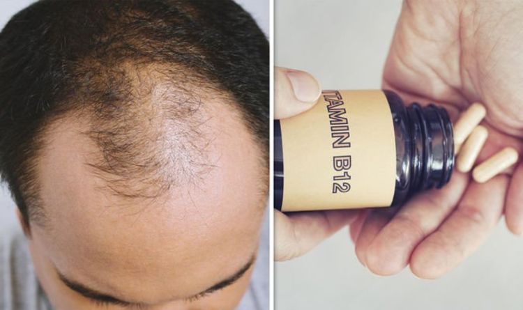 Hair loss treatment: Vitamin B12 supplementation could stop your hair thinning