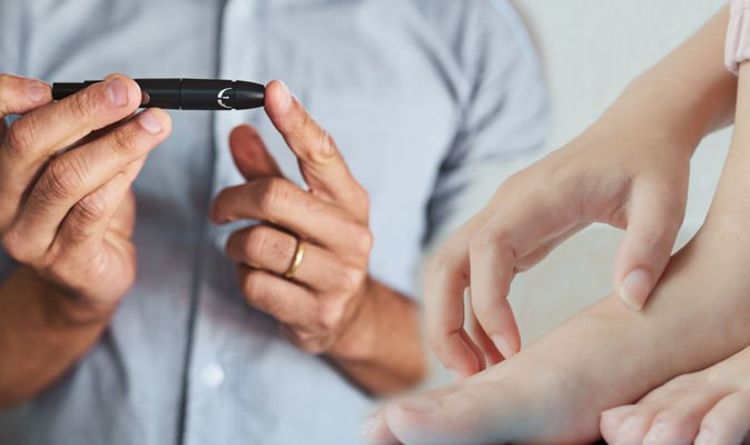 Type 2 diabetes: Vaginal, yeast, bladder and skin infections are signs of high blood sugar