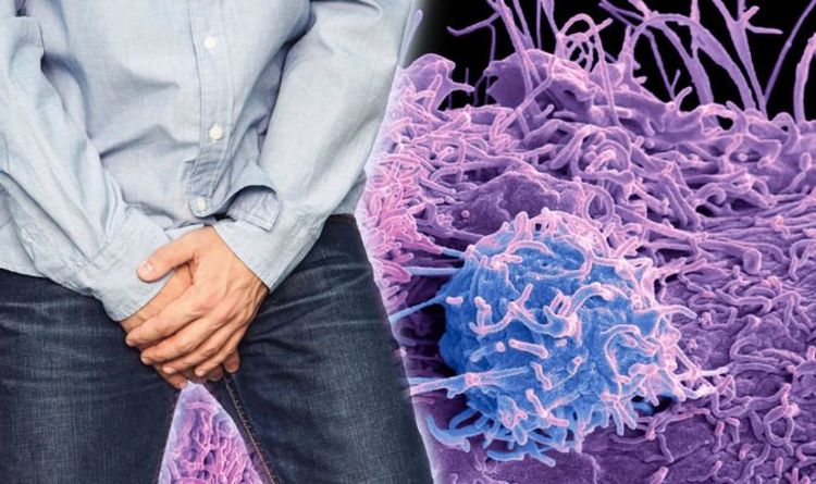 Prostate cancer: Pain in testicles could indicate the cancer has spread