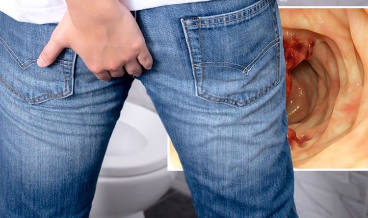 Bowel cancer symptoms: A change in your normal bowel habit is a warning sign