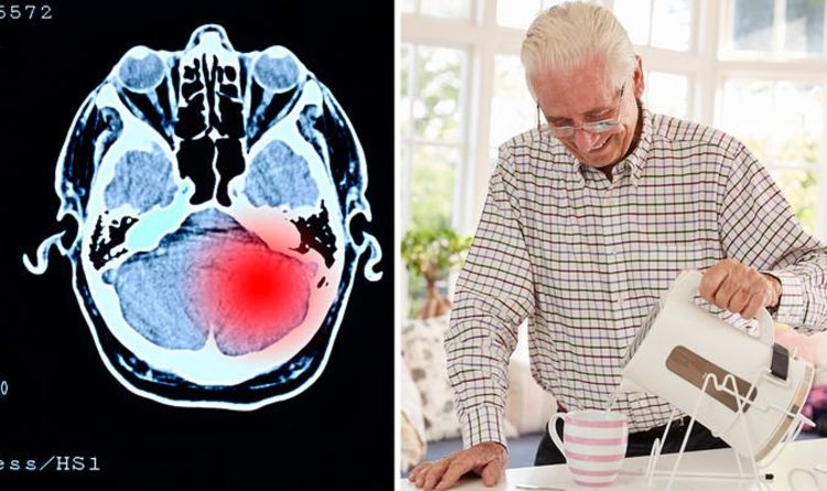 Dementia symptoms: Are you forgetful or is it a symptom of the condition? Signs to spot