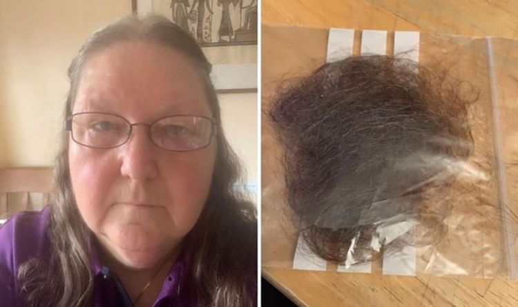 New covid symptom: ‘Most of my hair ended up falling out’ - hair loss symptom