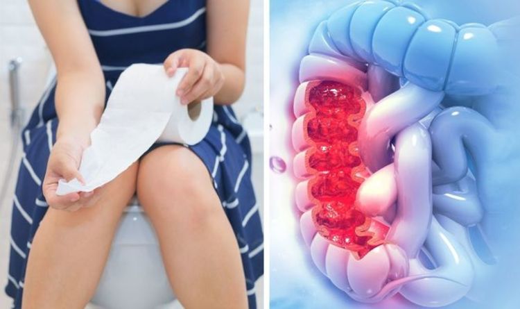 Bowel cancer symptoms: Subtle change to the appearance of your poo you shouldn't ignore