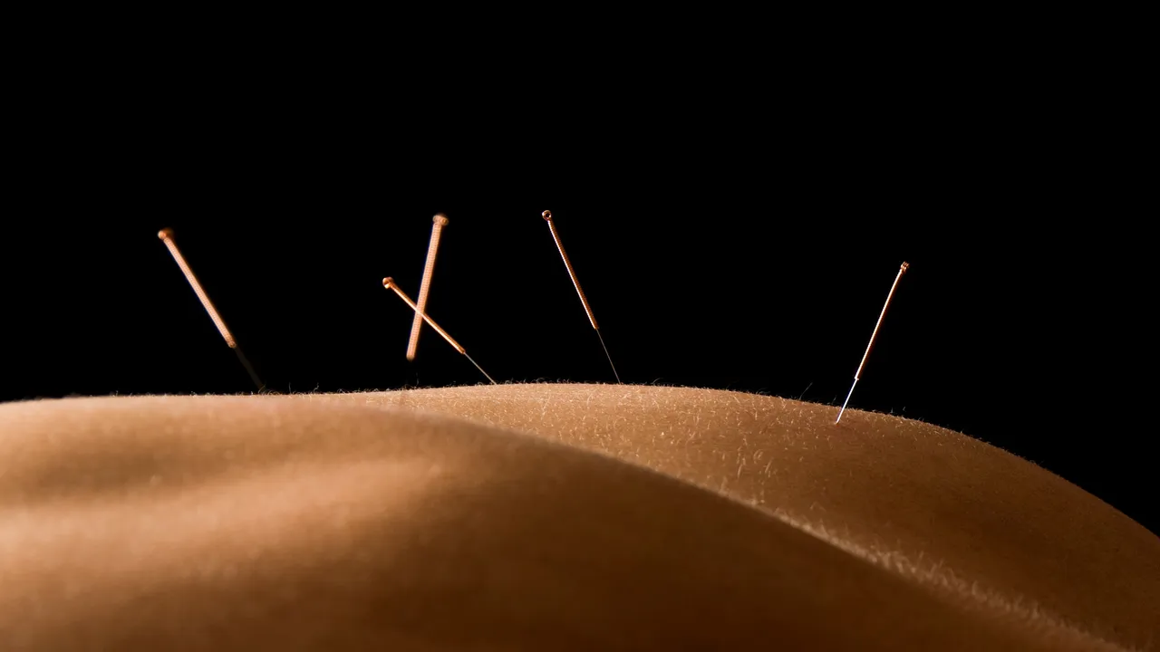 Why Summer Is the Perfect Time to Start Getting Acupuncture