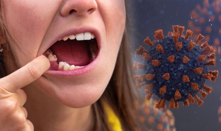 New long-Covid symptom: Coronavirus may cause sufferers’ teeth to fall out, say dentists