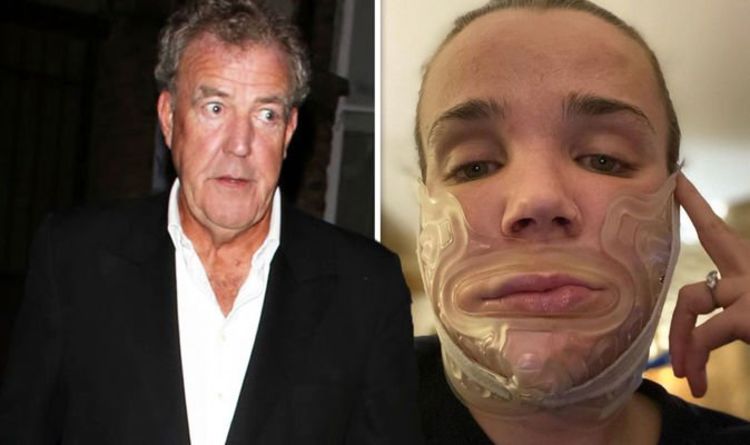 Jeremy Clarkson's daughter gives 'painful' update after jaw broken 'Got two slipped discs'