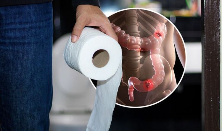 Bowel cancer symptoms: The shape and size of your poo is a sign