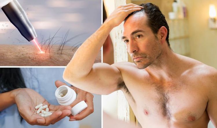 Best hair loss treatment: Three non-surgical treatments backed by concrete evidence