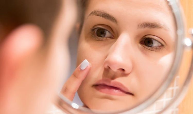 How to get rid of spots
