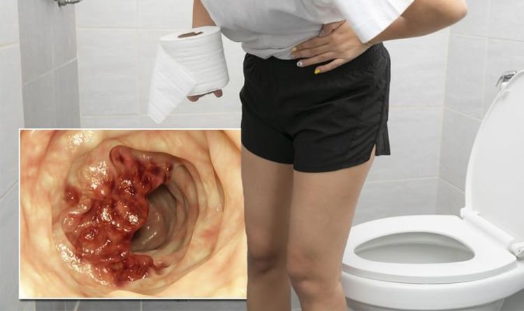 Bowel cancer: The unusual sensation relating to bowel movement that may be a warning sign