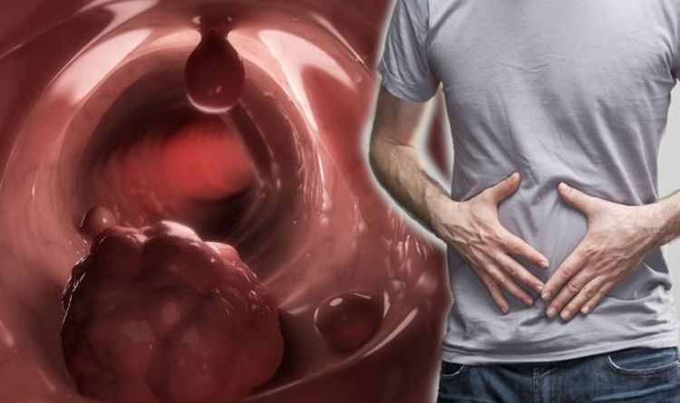 Bowel cancer: Feeling you need to empty your bowels with little or no stool is a sign