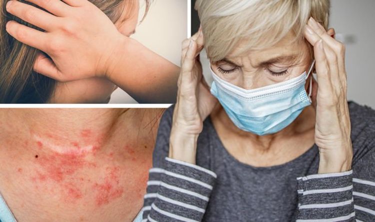 Coronavirus symptoms update: The 14 most common ‘long Covid’ symptoms - what to look for
