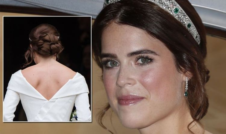 Princess Eugenie's spinal condition - 'surgeons inserted eight-inch rods into my spine'