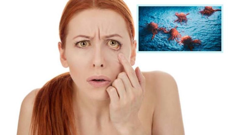 Pancreatic cancer symptoms: Two 'early warning signs' of the 'silent disease'