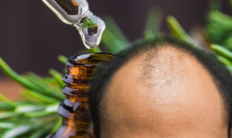 Hair loss treatment: Rosemary oil has shown promising results in treating alopecia