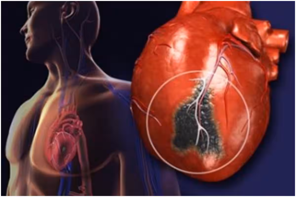 Know Everything About Preventive Cardiology, an Emerging Field to Prevent Heart Diseases