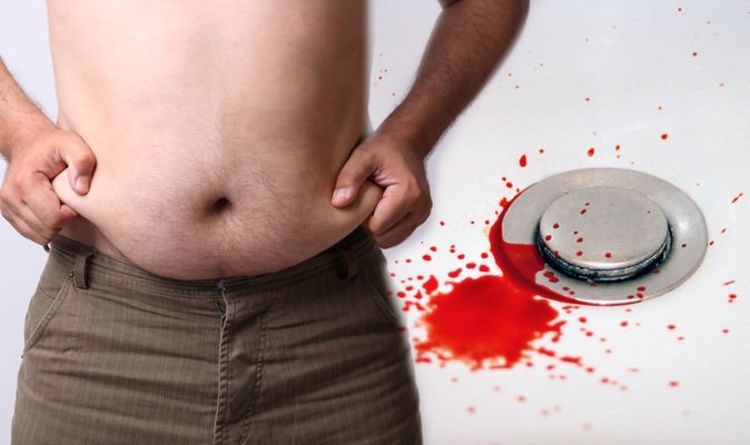 Fatty liver disease: Early warning risks could include unusual bleeding - like nosebleeds