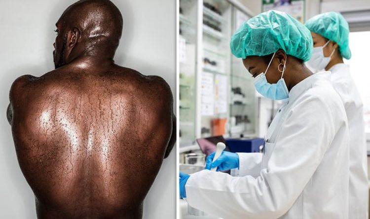 Parkinson's disease: 'Game-changing' skin swab could diagnose the condition