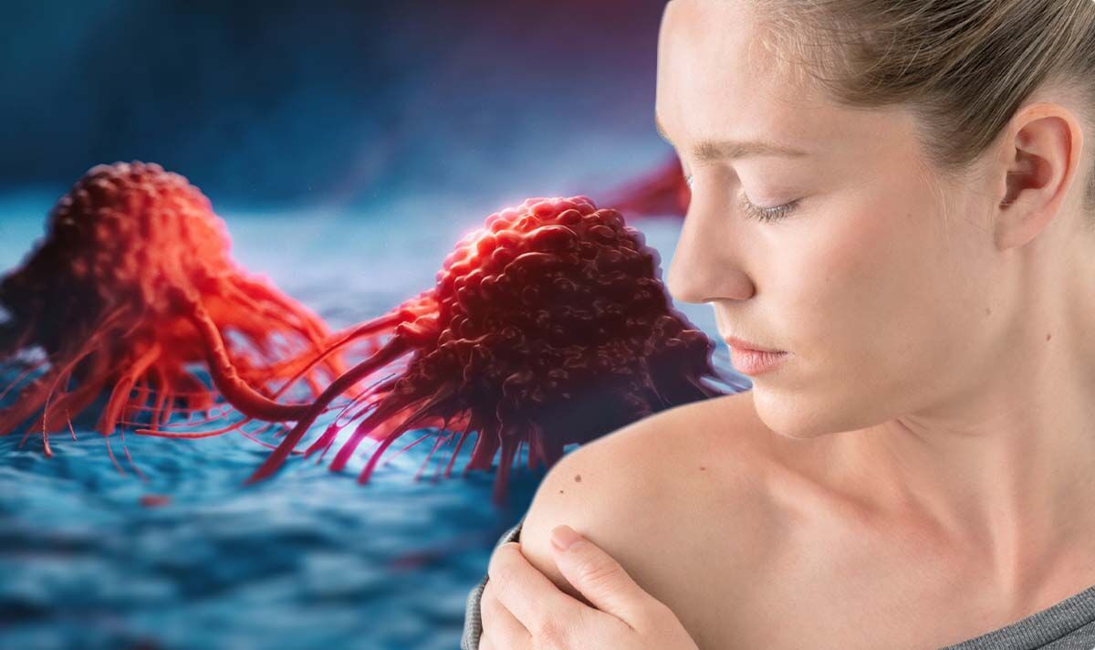 Cancer: The ‘hidden’ spots where cancer can appear - ‘Areas you may never consider'
